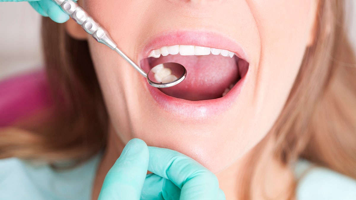 Most common causes of cavities in the teeth — and how to prevent them  at george magazine