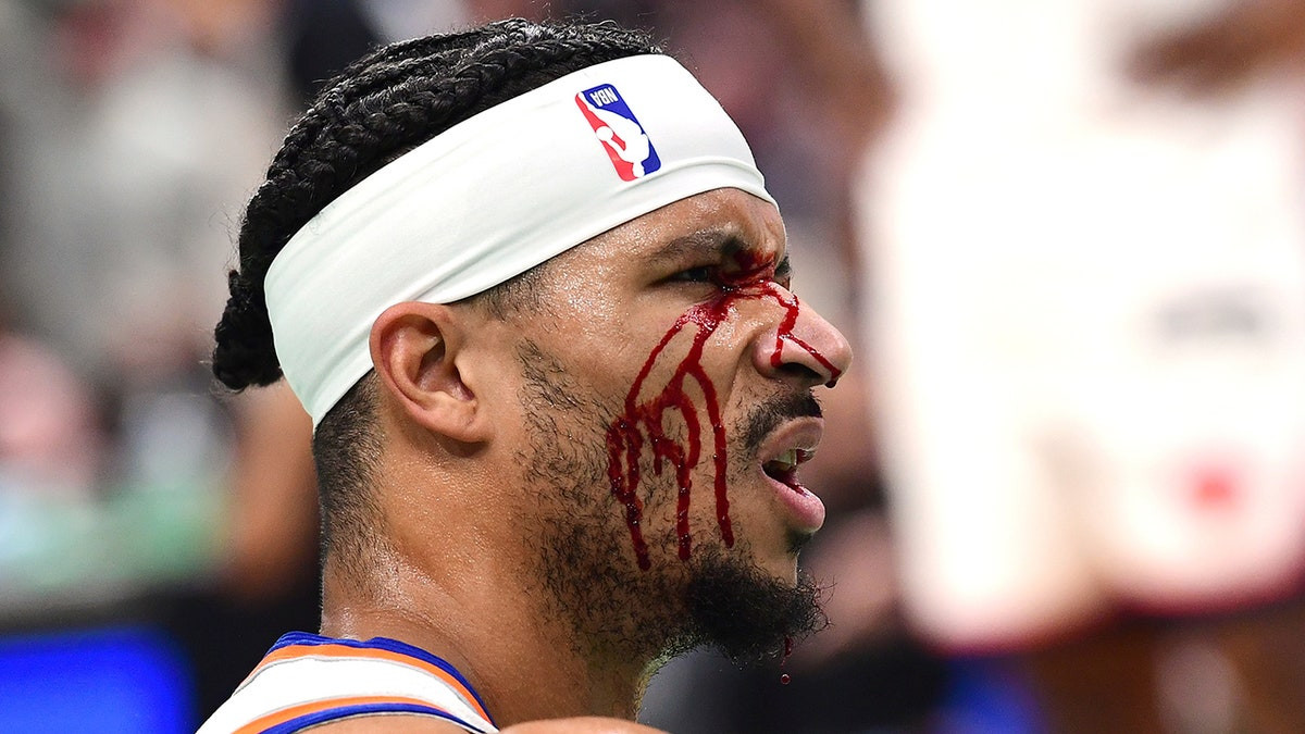 Knicks' Josh Hart suffers bloody cut over eye in team's loss to Celtics  at george magazine