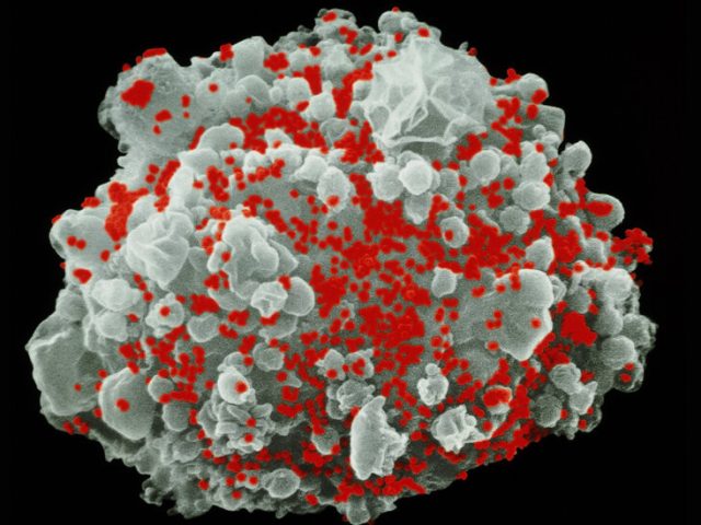 Used in Covid Shots, mRNA May Help Rid the Body of H.I.V.