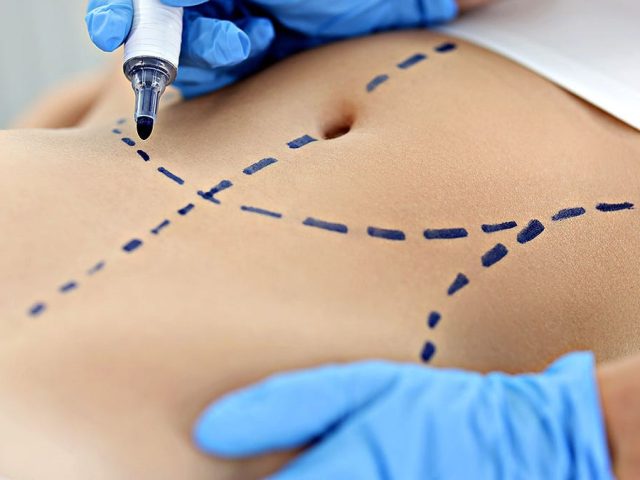 Top cosmetic procedures revealed in new report: What’s trending and why