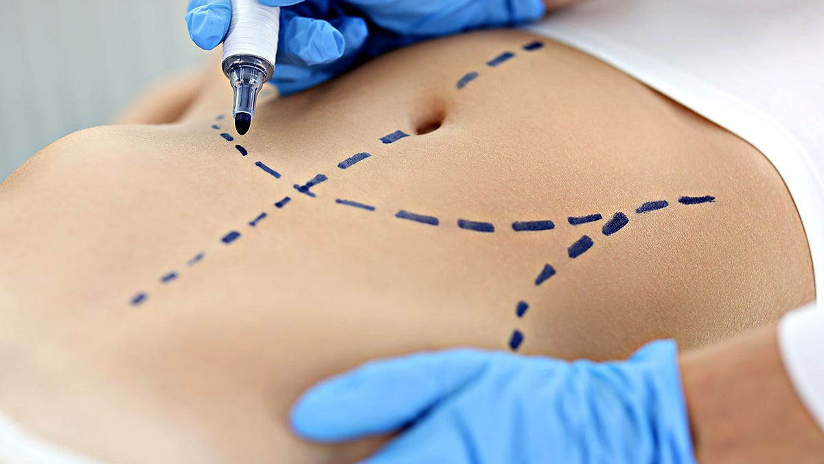 Top cosmetic procedures revealed in new report: What's trending and why  at george magazine