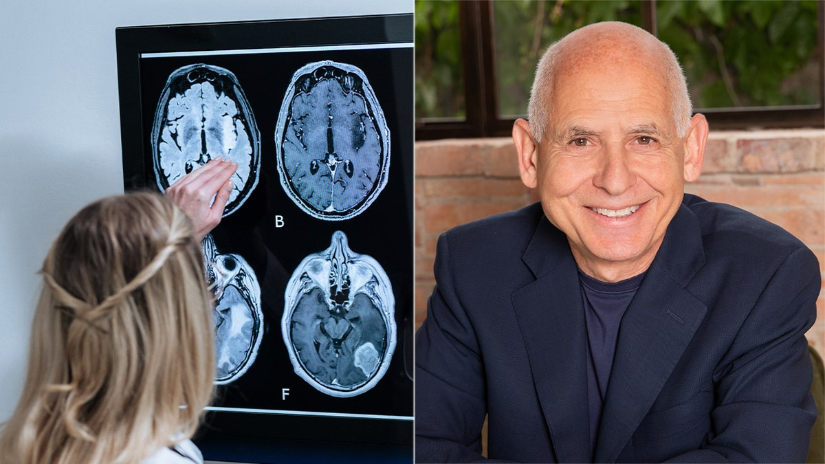 Making these 11 lifestyle changes could ward off Alzheimer's, expert says  at george magazine