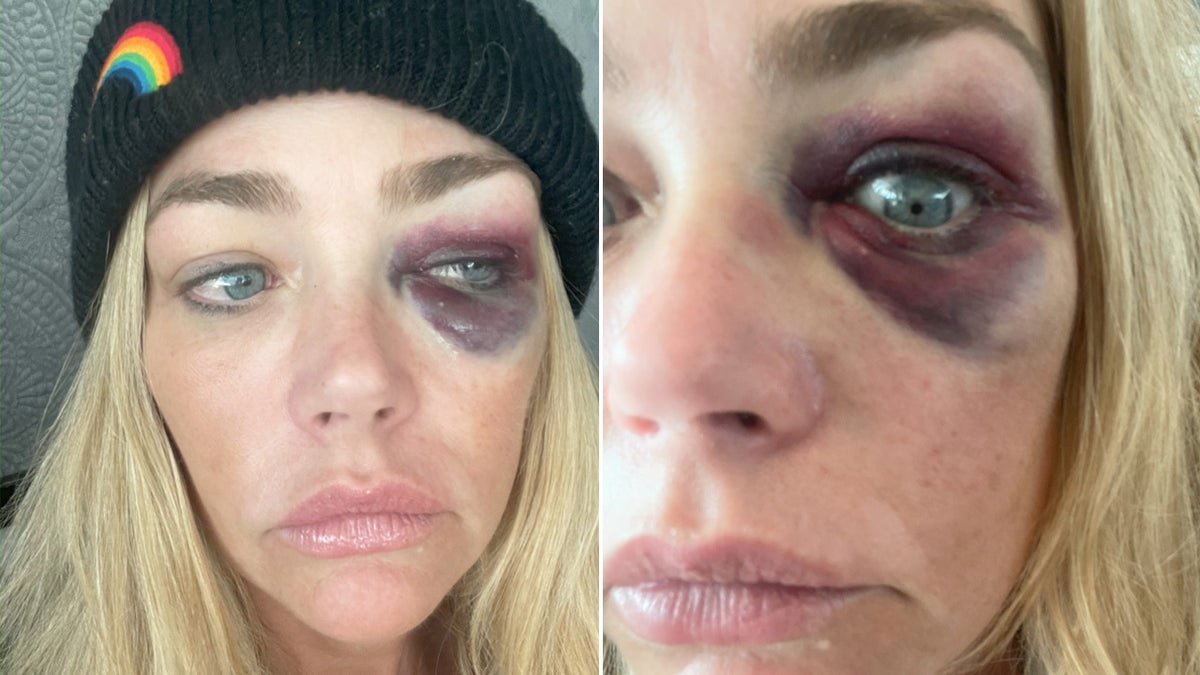 Denise Richards accuses estranged husband of abuse and death threats in restraining order filing  at george magazine