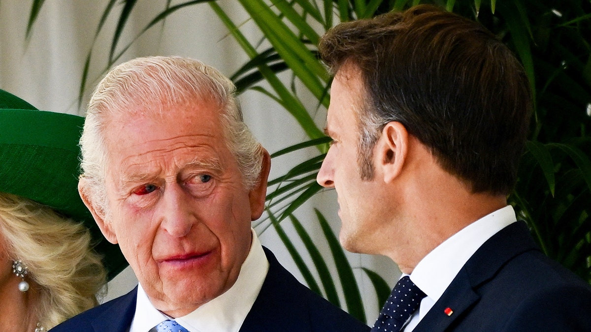 King Charles’ alarming bloodshot eye raises health concern during French state visit  at george magazine