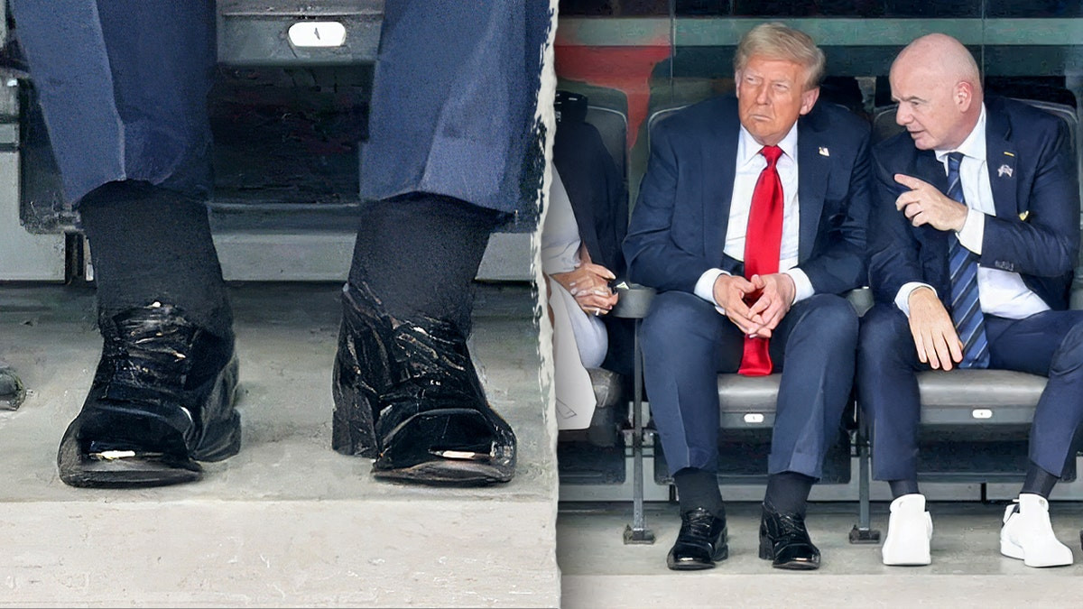 Doctors react to alleged Trump health concerns as photos show swelling and bruising  at george magazine