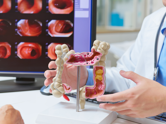 Colorectal cancer diagnoses soar among younger adults for one key reason