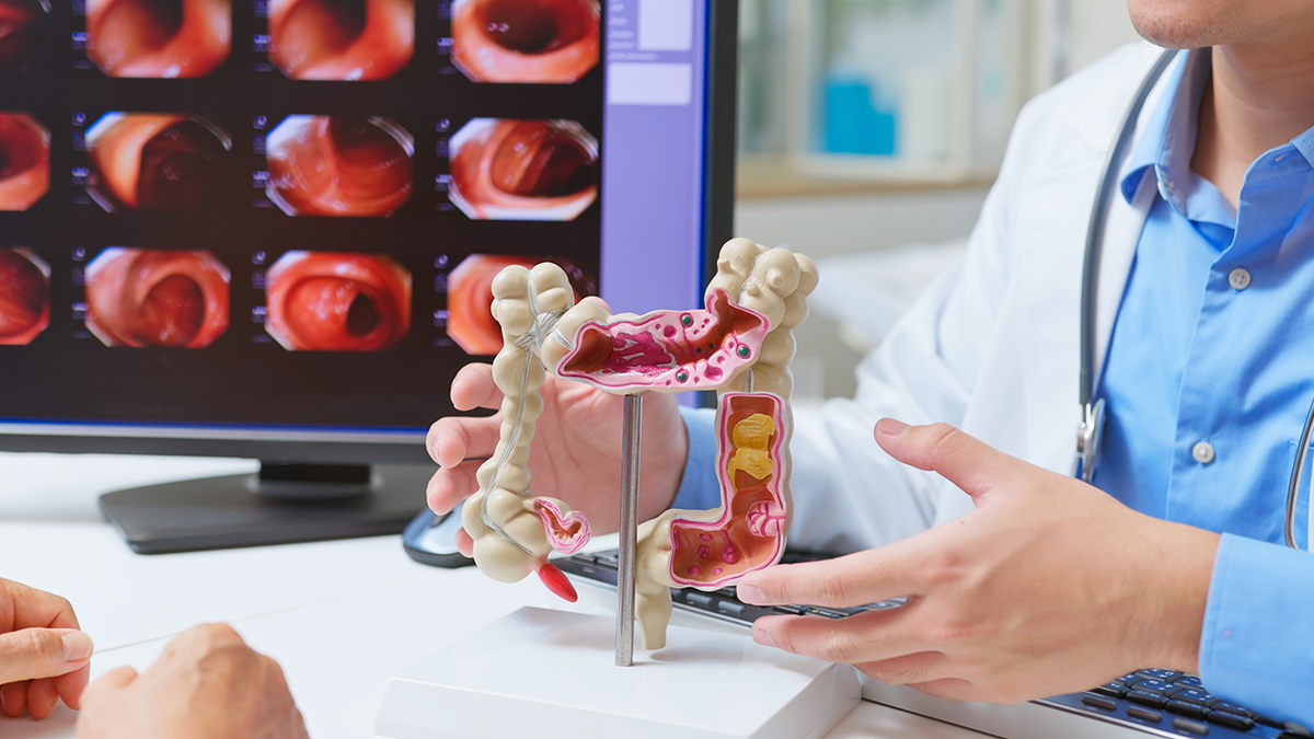 Colorectal cancer diagnoses soar among younger adults for one key reason  at george magazine