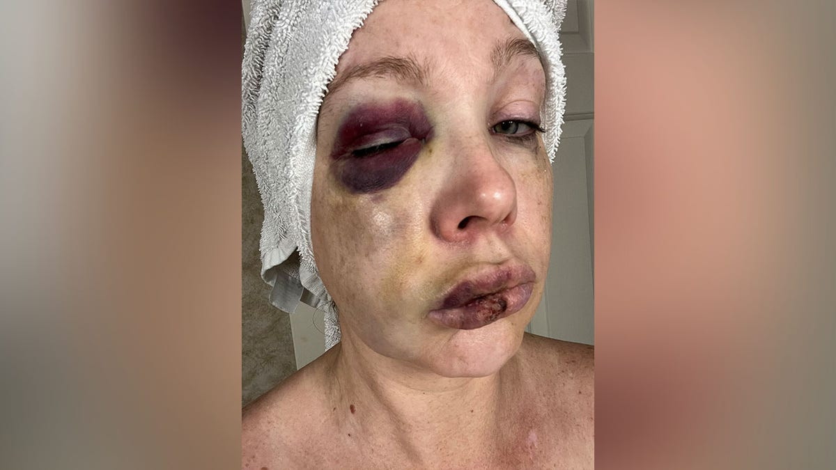 Three major broadcast networks didn't report on heinous Cincinnati brawl, review finds  at george magazine