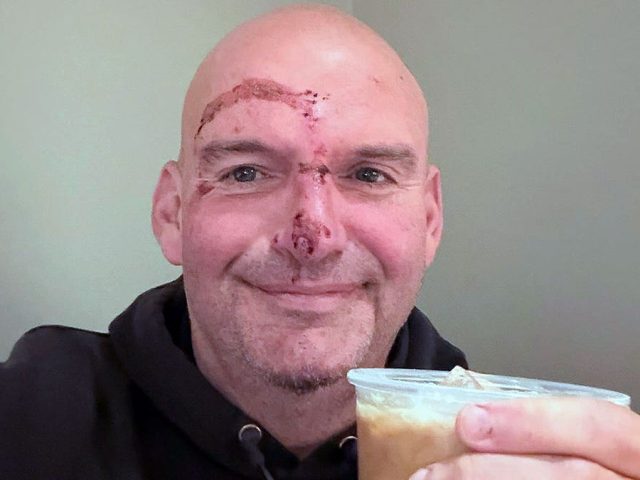 Sen. Fetterman shares graphic photo after heart rhythm scare, says doctors ‘put me back together’