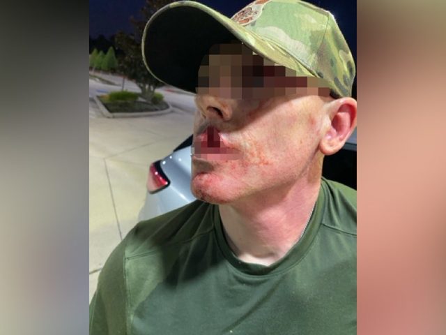 ICE officer seriously injured after illegal immigrant assault, using metal coffee cup