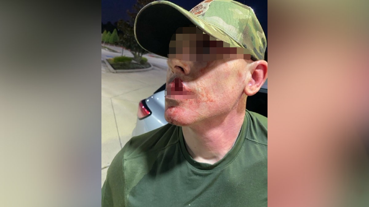 ICE officer seriously injured after illegal immigrant assault, using metal coffee cup  at george magazine