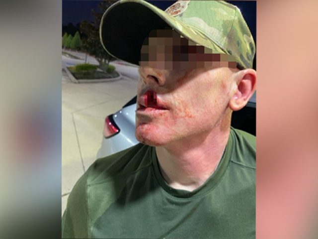 Sanctuary politicians’ rhetoric led to 1,150% surge in violence against ICE agents: DHS