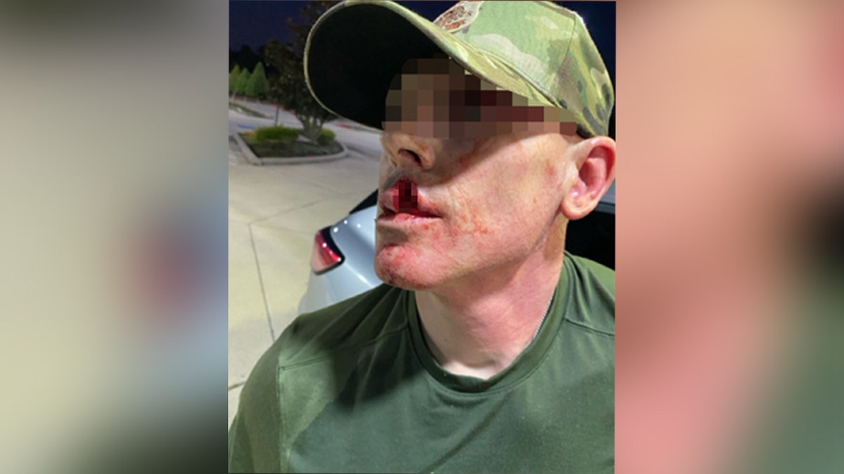 Sanctuary politicians' rhetoric led to 1,150% surge in violence against ICE agents: DHS  at george magazine