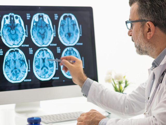 Brain health warning sign could be hiding in plain sight, say researchers