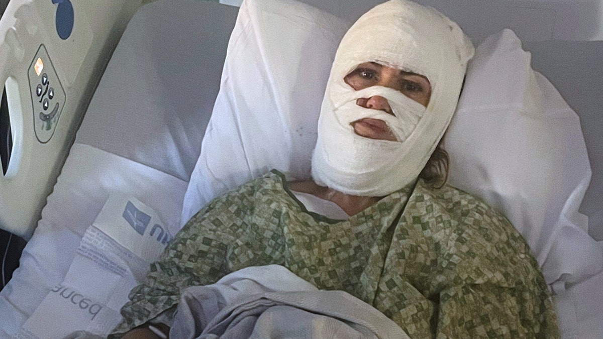 Georgia woman hospitalized after attacker hurls corrosive chemical during evening walk at george magazine