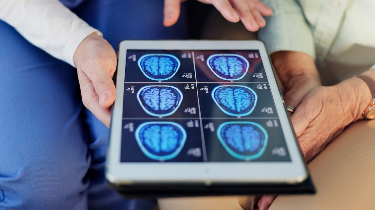 Common supplements deliver breakthrough results against brain cancer in early study at george magazine