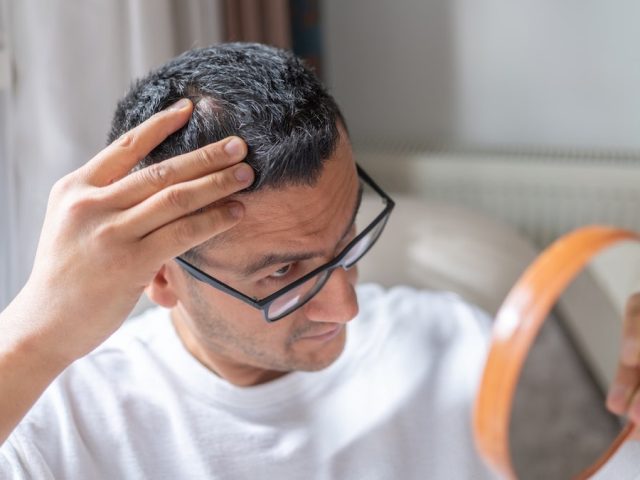 New baldness treatment shows dramatic hair-regrowth gains in major trial