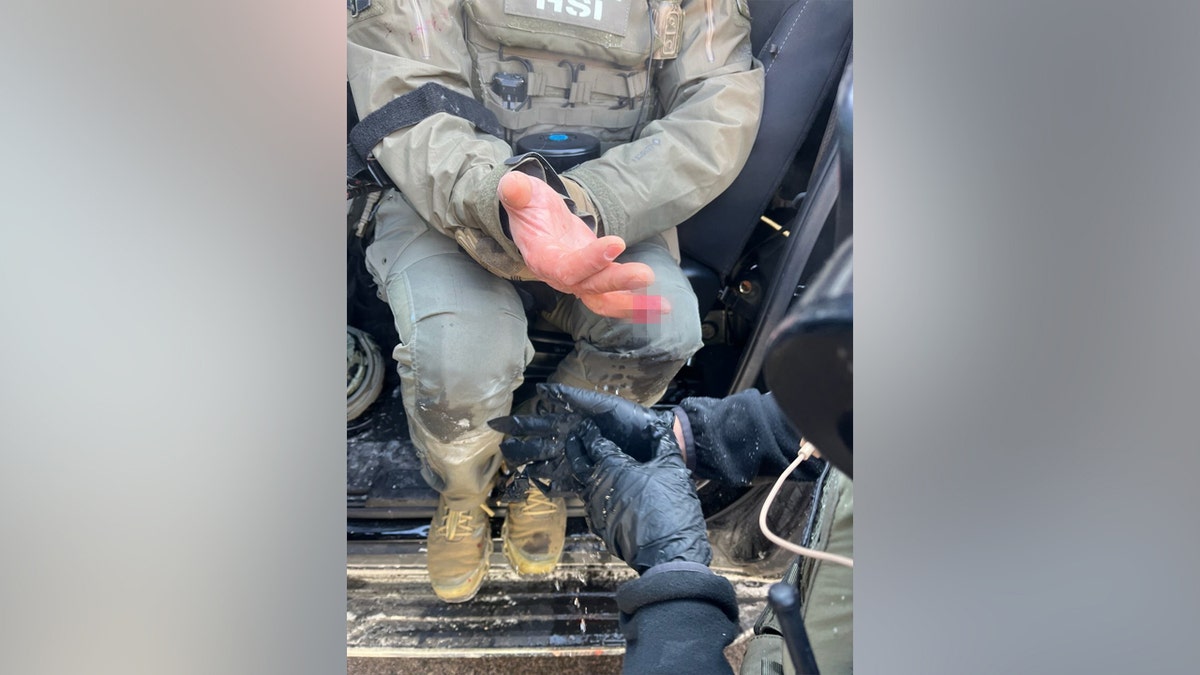 Anti-ICE agitator allegedly bites off federal officer's finger during Minneapolis attack at george magazine