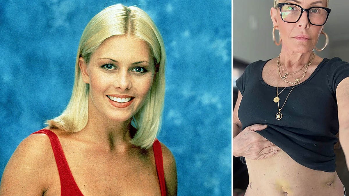 'Baywatch' star Nicole Eggert undergoes major cancer surgery after alarming test results at george magazine