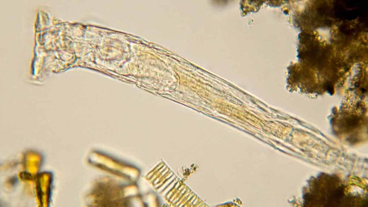 A close up microscopic image of rotifer