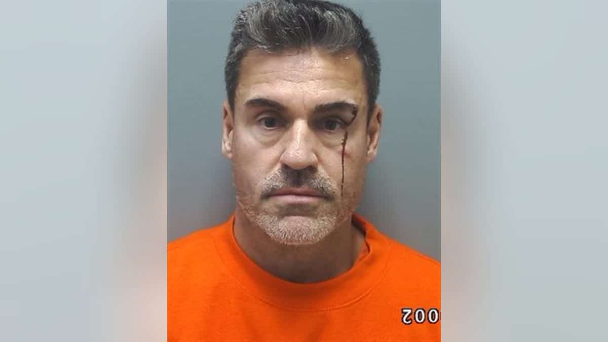 Mugshot of David Landsman wearing an orange shirt with a visible cut above his right eye and dried blood running down his cheek.