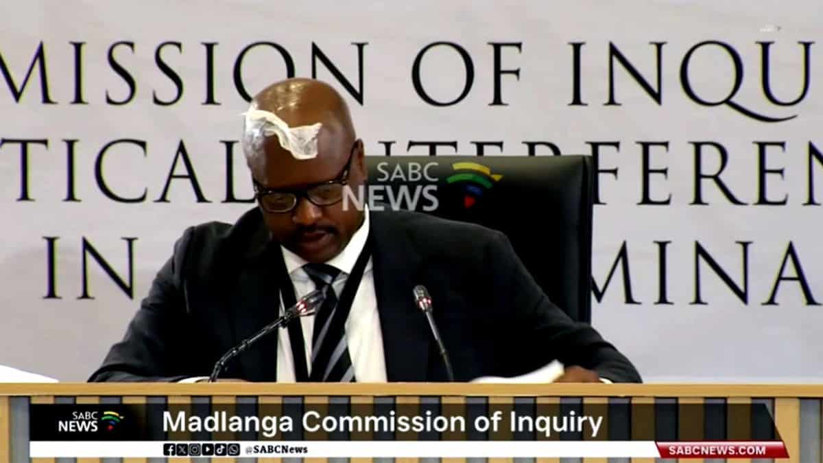 Julius Mkhwanazi with tissue stuck on forehead