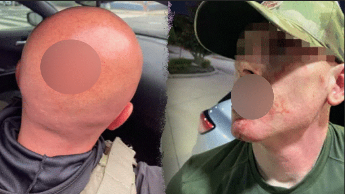 Injured ICE agents.
