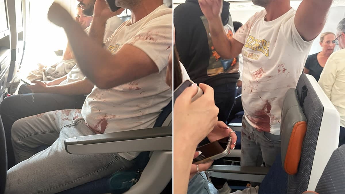 passenger blood on t-shirt